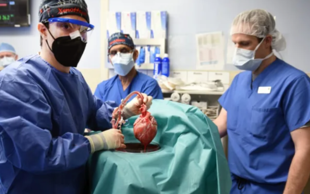 医护人员正在拿猪的心脏进行移植